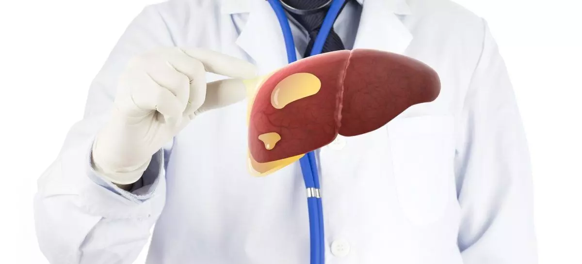 DASH Diet reveals Significant Benefits for Liver Health for Patients with NAFLD